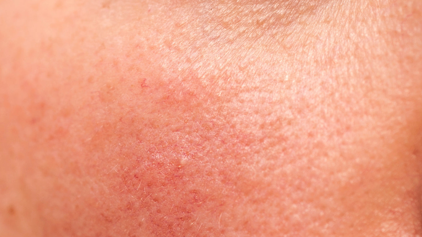 Partie einer älteren Dame mit Mischhaut