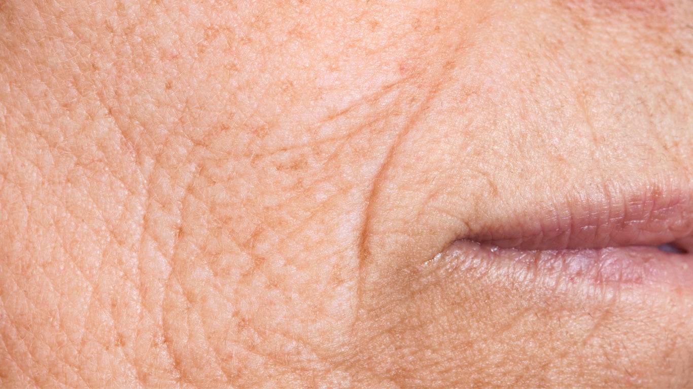 Wangenpartie reifer Haut einer älteren Dame 