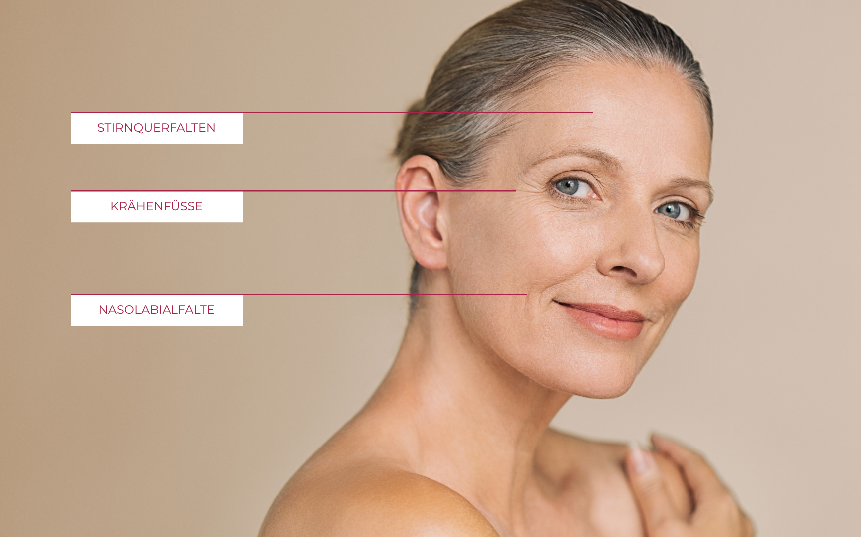 Lächelnde Frau mittleren Alters mit beschrifteten Gesichtsfalten: Stirnquerfalten über den Augenbrauen, Krähenfüße unter den Augen und Kinnquerfalten seitlich am Mund.