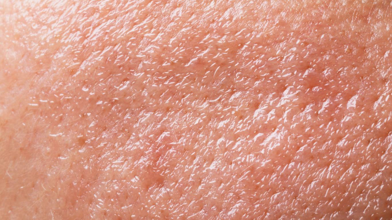 Glänzende, fettige Haut im Detail mit sichtbaren Poren und öliger Oberfläche